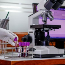 Prueba de hemoglobina glicosilada