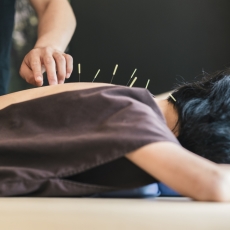 Acupuntura