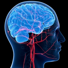 Malformaciones arteriovenosas
