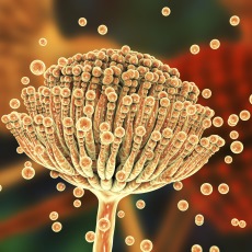 Aspergilosis