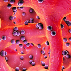 Infecciones de los huesos