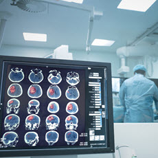 Tumores cerebrales