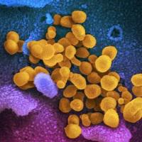 Enfermedad del coronavirus 2019 (COVID-19)