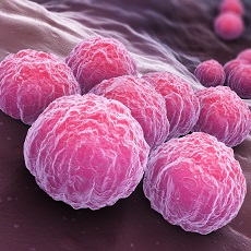 Infecciones por clamidia