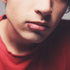 Herpes labial