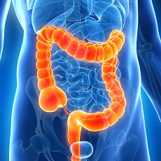 Enfermedades del colon