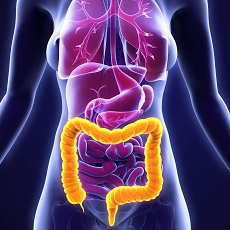Pólipos del colon