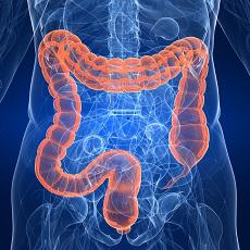 Cáncer del colon y del recto