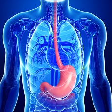Esofagitis eosinofílica