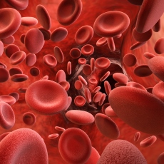 Hemocromatosis