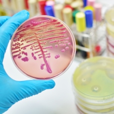 Enfermedades infecciosas