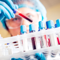 Pruebas de laboratorio