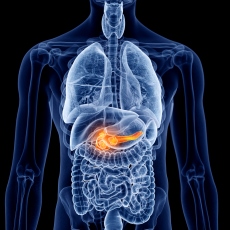 Cáncer de páncreas