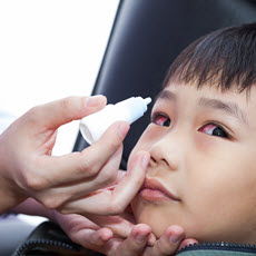 Conjuntivitis