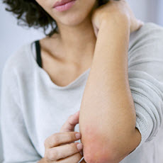 Artritis psoriásica