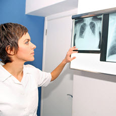 Hipertensión pulmonar