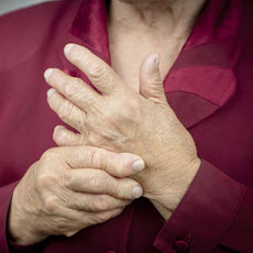Artritis reumatoide