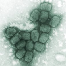 Viruela