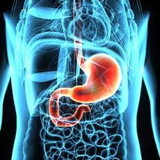 Cáncer de estómago