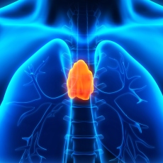 Cáncer de timo
