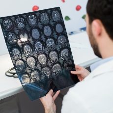 Lesión cerebral traumática