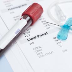 Lipoproteína de muy baja densidad (VLDL)