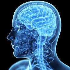 Accidente cerebrovascular