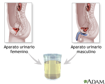 Muestra de orina Muestra de orina