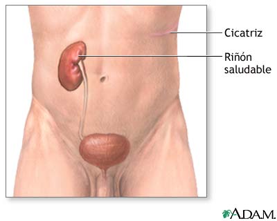 Cuidados postoperatorios Cuidados postoperatorios
