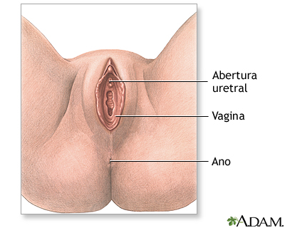 Reparación anterior de la vagina (incontinencia urinaria - tratamiento quirúrgico) - serie Reparación anterior de la vagina (incontinencia urinaria - tratamiento quirúrgico) - serie