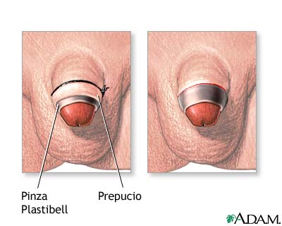 Procedimiento Procedimiento