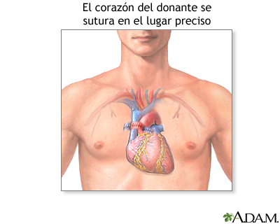 Cuidados postoperatorios Cuidados postoperatorios