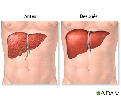 Cuidados postoperatorios Cuidados postoperatorios