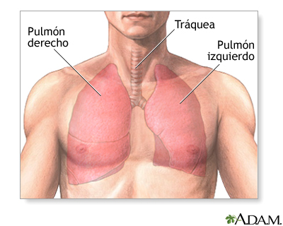 Lobectomía pulmonar - serie - Anatomía normal Lobectomía pulmonar - serie - Anatomía normal