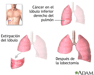 Procedimiento Procedimiento