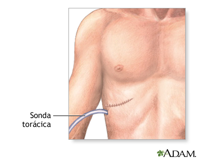 Cuidados postoperatorios Cuidados postoperatorios