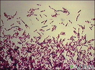 Organismo Clostridioides difficile Organismo Clostridioides difficile