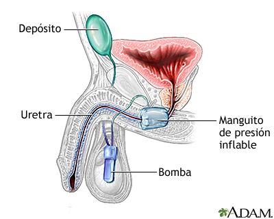 Procedimiento (segunda parte) Procedimiento (segunda parte)