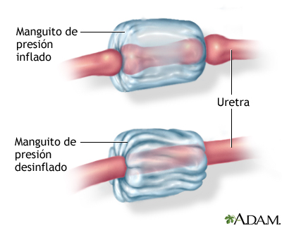 Procedimiento (tercera parte) Procedimiento (tercera parte)