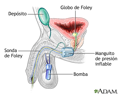 Cuidados postoperatorios Cuidados postoperatorios