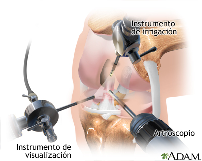 Procedimiento (primera parte) Procedimiento (primera parte)