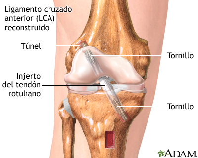 Cuidados postoperatorios Cuidados postoperatorios