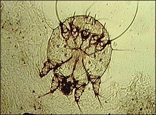 Microfotografía del ácaro de la escabiosis Microfotografía del ácaro de la escabiosis