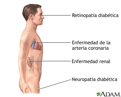 Indicaciones Indicaciones