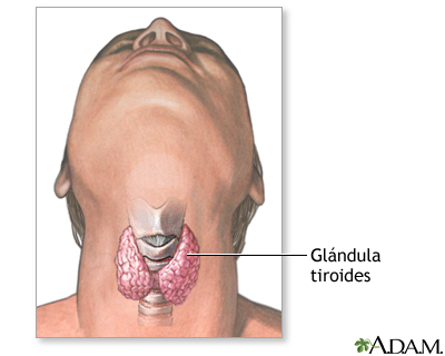 Tiroidectomía - Serie Tiroidectomía - Serie