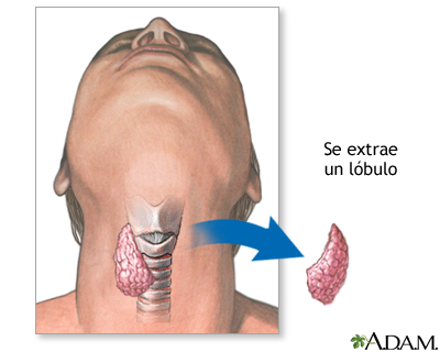 Procedure Procedure