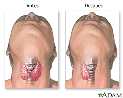 Cuidados postoperatorios Cuidados postoperatorios
