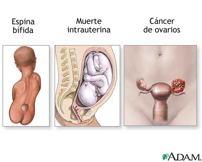 Resultados Resultados