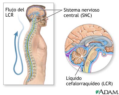 Esclerosis múltiple (diagnóstico) - serie Esclerosis múltiple (diagnóstico) - serie