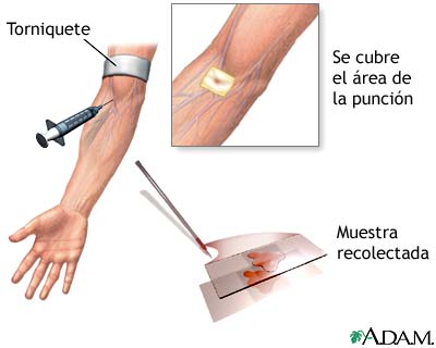 Procedimiento Procedimiento